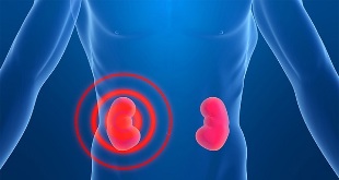 Kidney pain symptoms